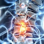 Décompression neurovertébrale: Contre indications