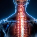Décompression neurovertébrale: Contre indications