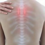 Décompression neurovertébrale: Contre indications