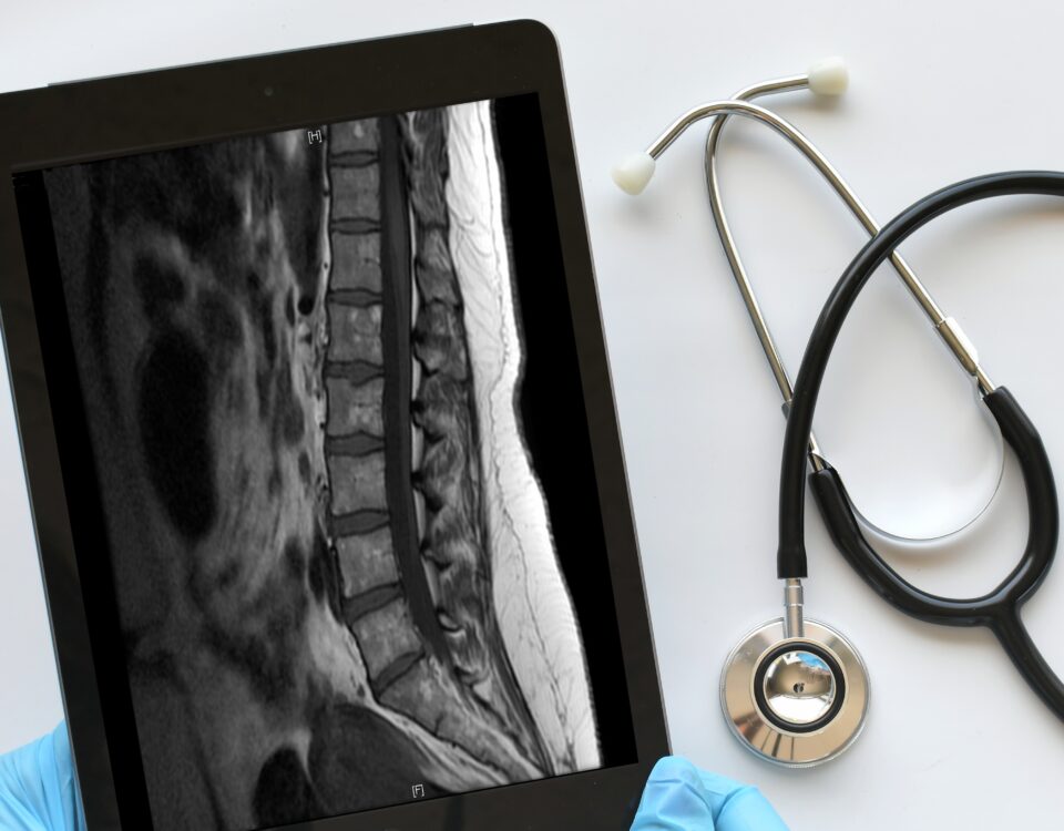 Medical professional technician using an iPad tablet to view and read MRI results e1699546450506