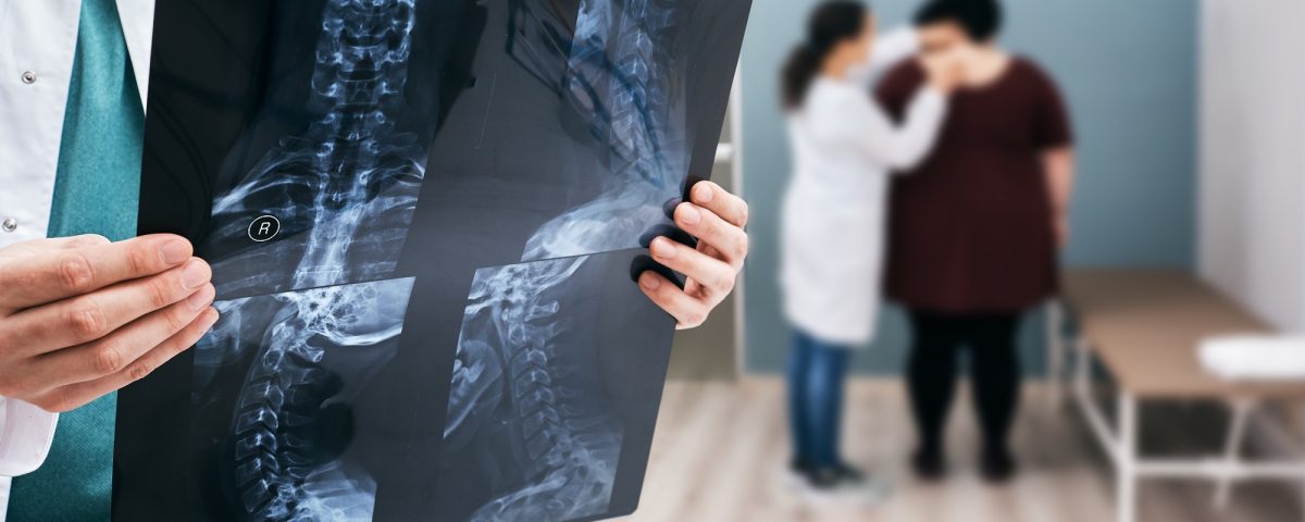 Doctor holds an x-ray of a cervical spine over background osteopath check-up overweight woman's