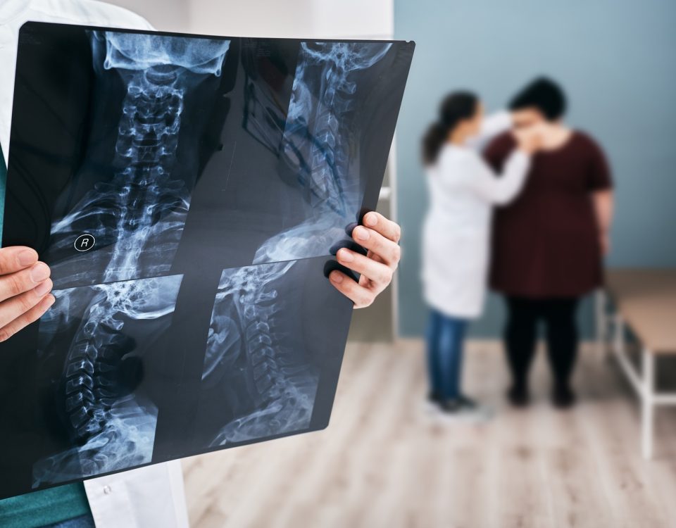 Doctor holds an x-ray of a cervical spine over background osteopath check-up overweight woman's