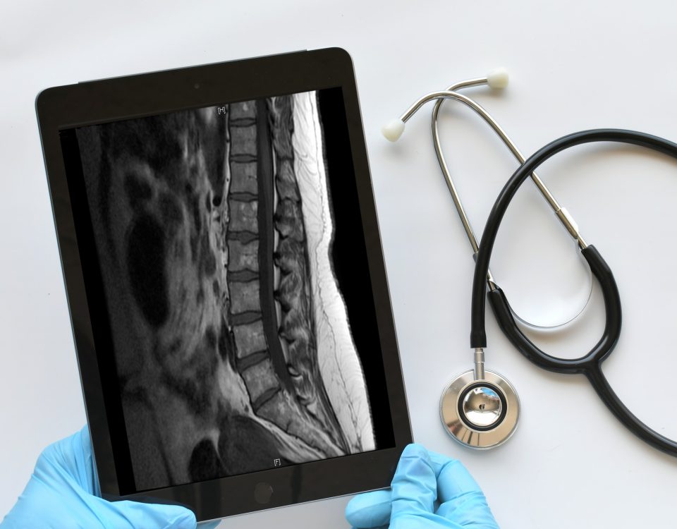 Sténose spinale 12 Doctor, medical professional technician using a computer tablet to view read MRI results