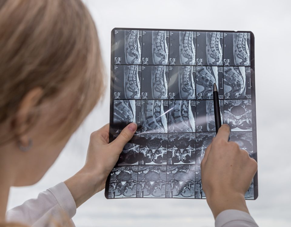 The doctor examines the result of an MRI of the spine