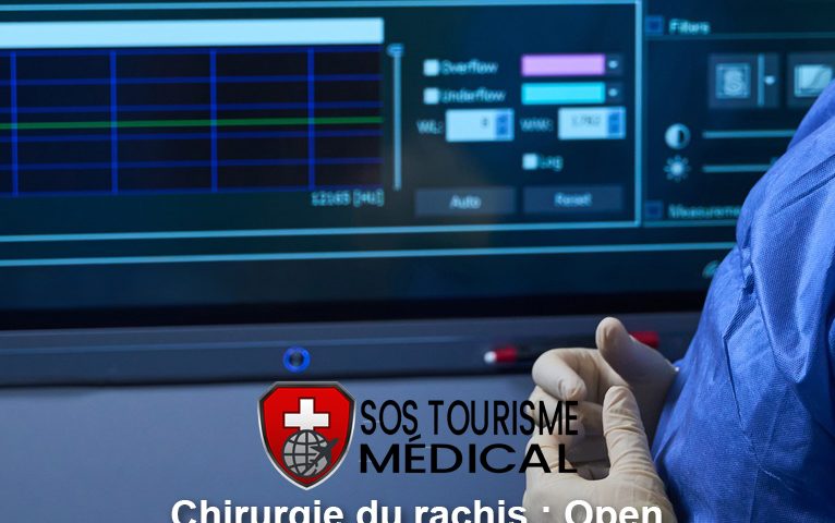 chirurgie du rachis opent