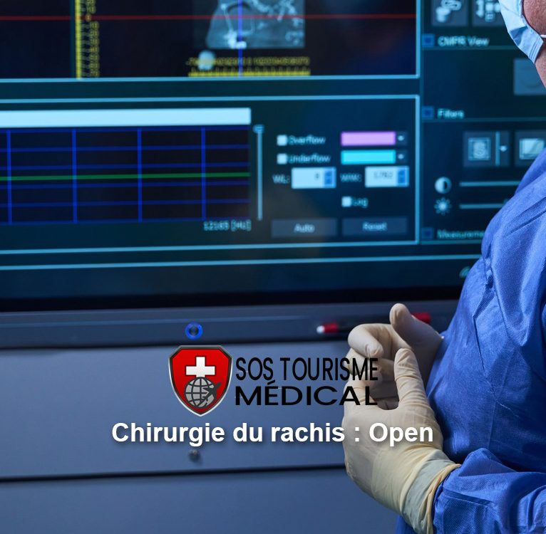chirurgie du rachis opent