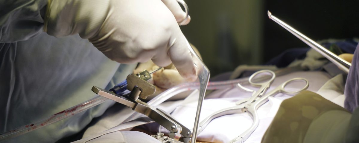 Doctors performing a spinal surgery under the lights in a hospital - surgical concept