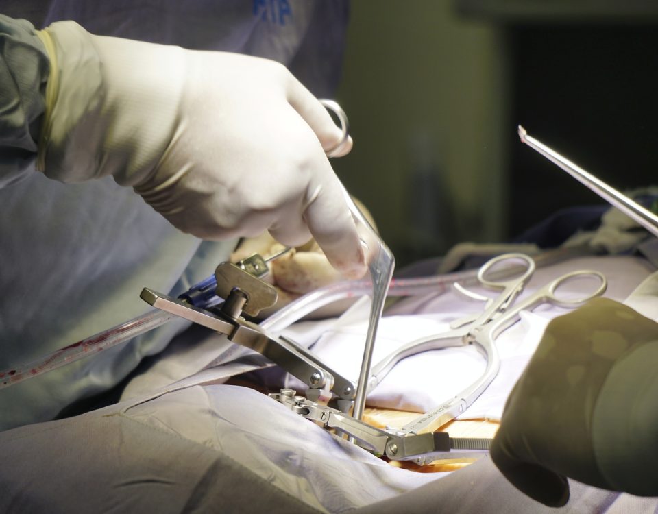 Doctors performing a spinal surgery under the lights in a hospital - surgical concept