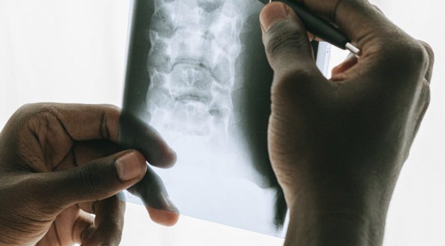 person holding black pen and an x ray
