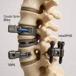 découvrez les meilleures stratégies pour bien se préparer à la technologie cousin spine et franchir. apprenez les conseils essentiels pour optimiser votre expérience et maîtriser ces innovations technologiques. préparez-vous efficacement afin de tirer le meilleur parti de ces outils.
